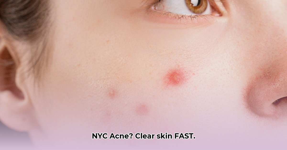 acne-clinic-nyc